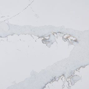 Calacatta Quartz Countertops RI